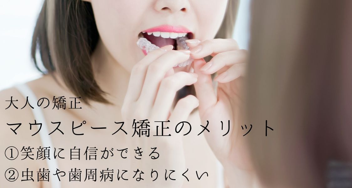香川県 高松市で目立たない矯正マウスピース矯正なら吉本歯科医院