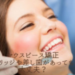 マウスピース矯正、ブリッジや差し歯があっても大丈夫？香川県高松市の吉本歯科医院