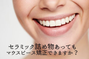 セラミック詰め物あってもマウスピース矯正できる？香川県 高松市の吉本歯科医院