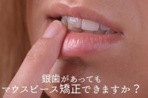 銀歯があってもマウスピース矯正できる？香川県 高松市の吉本歯科医院