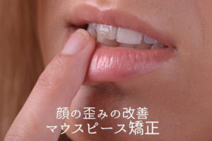 顔の歪みの改善｜マウスピース矯正　香川県 高松市の吉本歯科医院