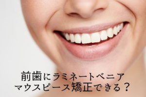 前歯にラミネートべニア　マウスピース矯正できる？香川県高松市の吉本歯科医院