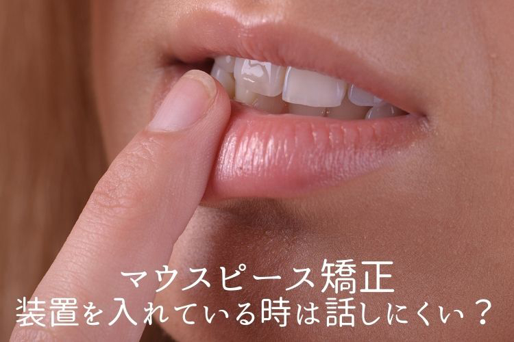 マウスピース矯正装置を入れている場合は話しにくい？香川県高松市の吉本歯科医院