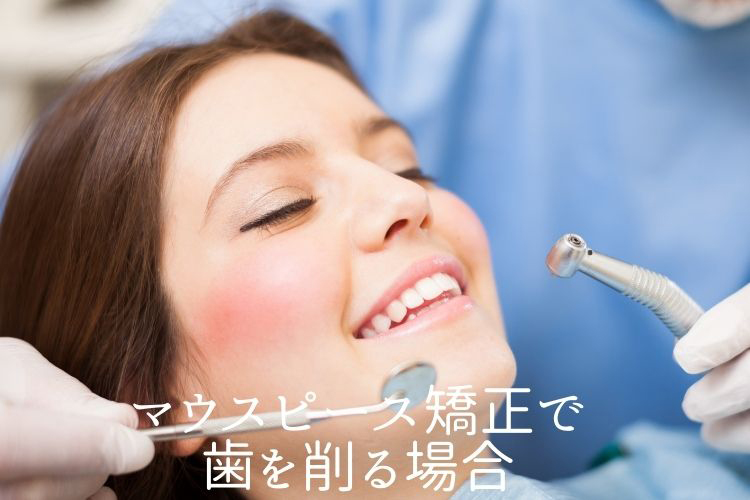 マウスピース矯正で歯を削る場合｜香川県高松市の吉本歯科医院