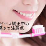 マウスピース矯正中の歯磨きの注意点｜香川県高松市の吉本歯科医院