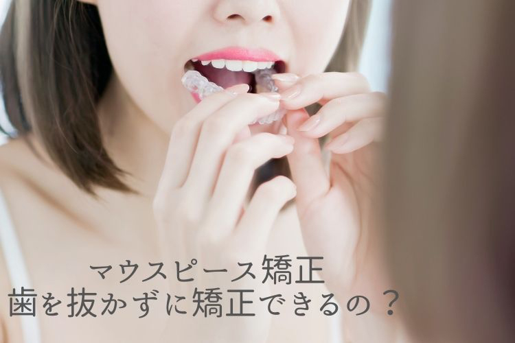 マウスピース矯正　歯を抜かずに矯正できるの？香川県高松市の吉本歯科医院