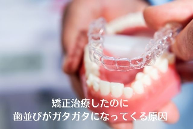 香川県 高松市で目立たない矯正マウスピース矯正なら吉本歯科医院