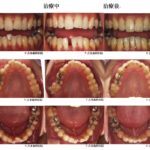 歯並び改善・マウスピース矯正なら香川県 高松市の吉本歯科医院